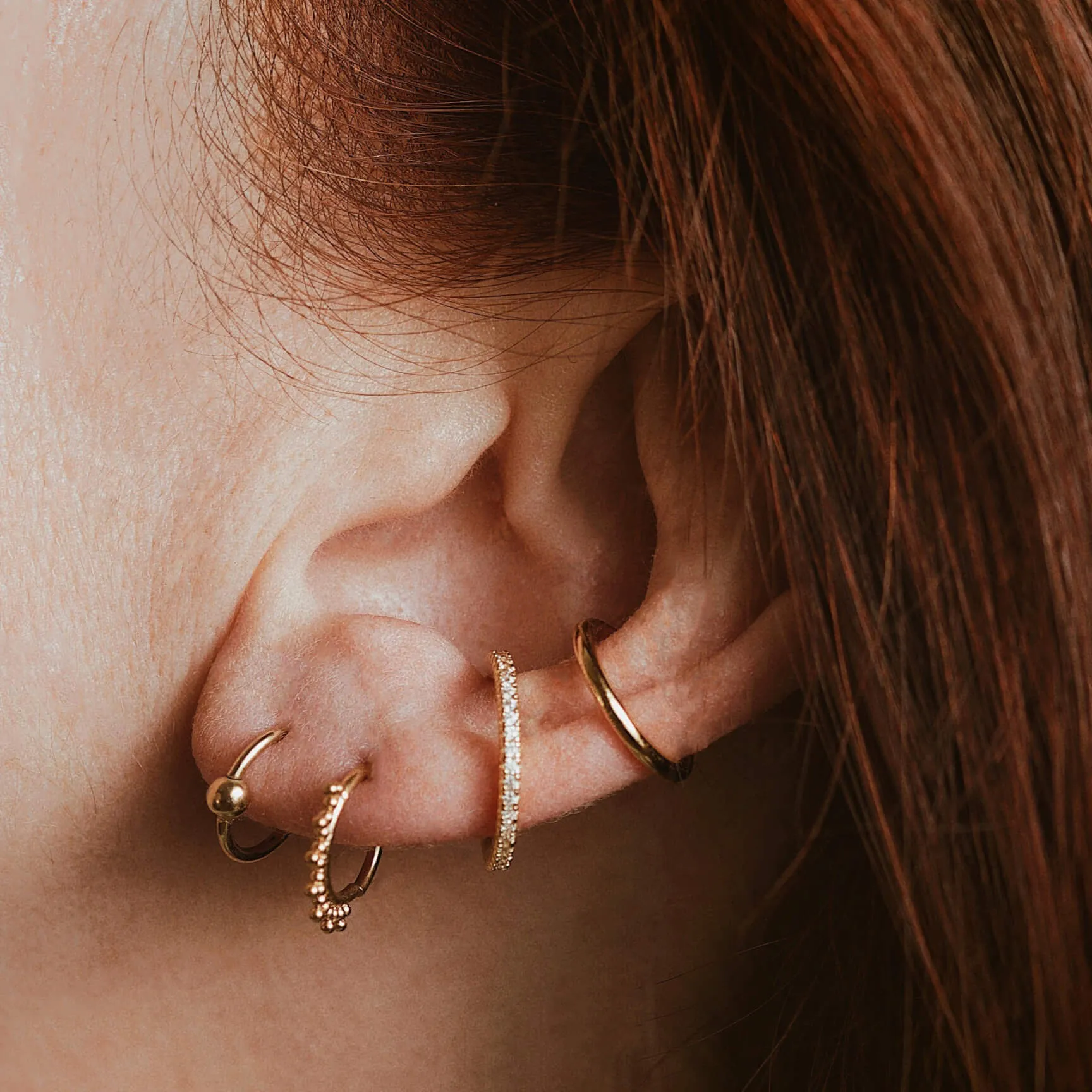Orbital Cartilage Hoop