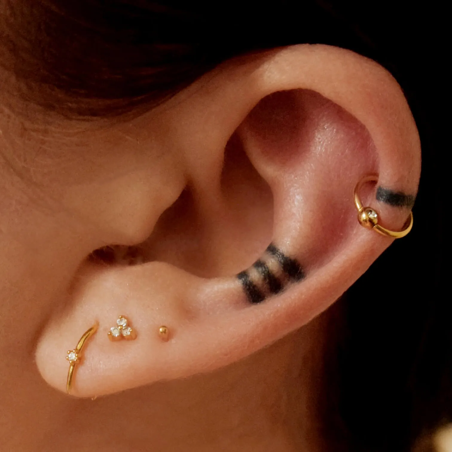 Orbital Cartilage Hoop